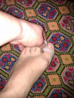 Ортопедическое изделие Valgus Pro для деформированного большого пальца фото