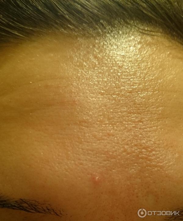 Корректирующее средство локального действия La Roche-Posay Effaclar AI фото