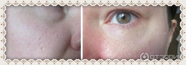 Маска для кожи вокруг глаз Tony Moly Panda's Dream фото