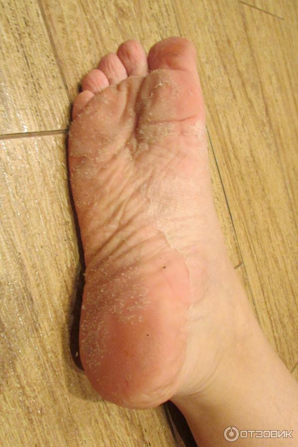 Носки педикюрные пилинговые MiFo Super Exfoliating Foot Socks For Pedicure фото