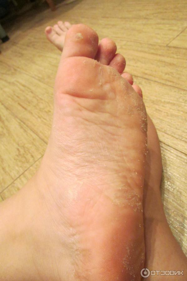 Носки педикюрные пилинговые MiFo Super Exfoliating Foot Socks For Pedicure фото