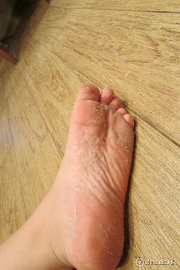 Носки педикюрные пилинговые MiFo Super Exfoliating Foot Socks For Pedicure фото