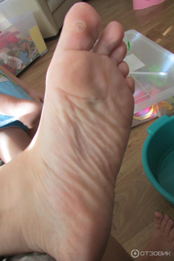 Носки педикюрные пилинговые MiFo Super Exfoliating Foot Socks For Pedicure фото