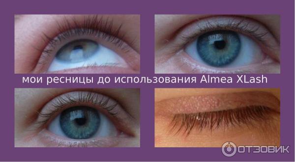 Средство для роста ресниц Almea XLash фото