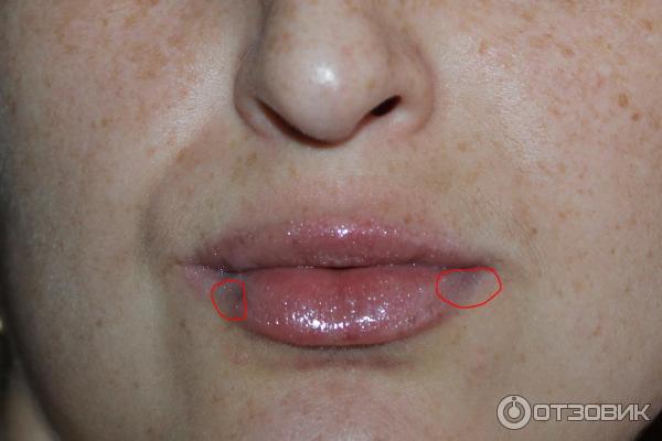 Прибор для увеличения губ Fullips фото