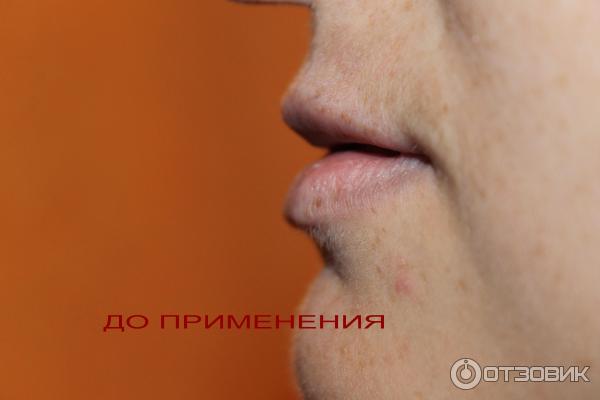 Прибор для увеличения губ Fullips фото