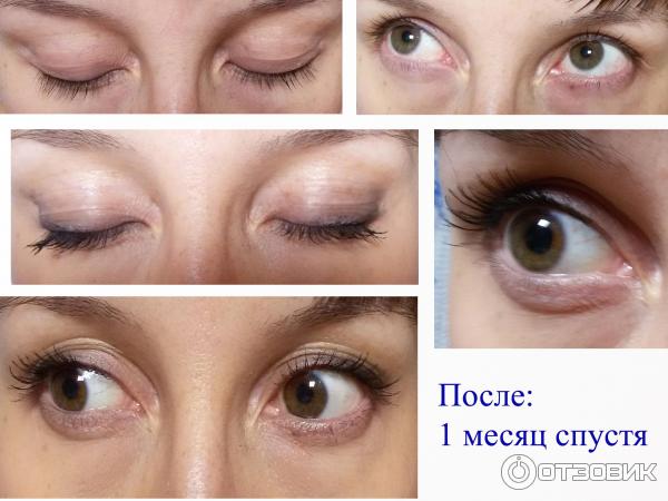 Средство для роста ресниц Almea XLash фото