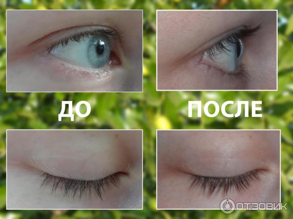 Средство для роста ресниц Almea XLash фото