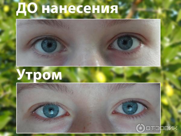 Средство для роста ресниц Almea XLash фото