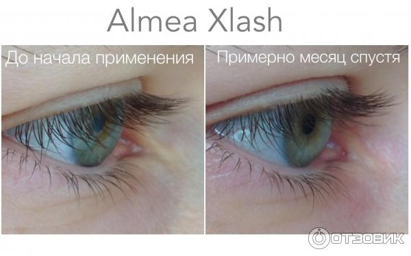 Средство для роста ресниц Almea XLash фото