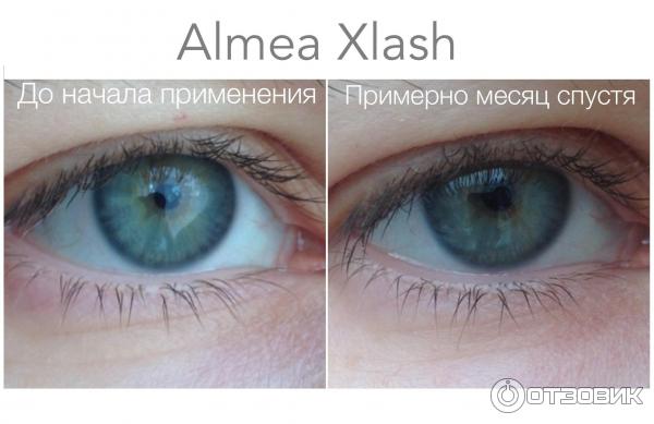 Средство для роста ресниц Almea XLash фото