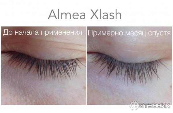 Средство для роста ресниц Almea XLash фото