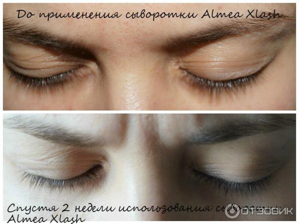 Средство для роста ресниц Almea XLash фото