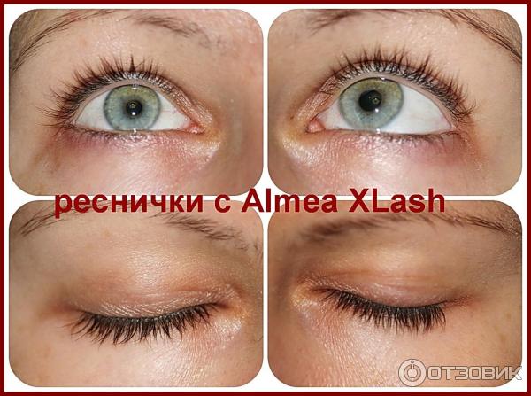 Средство для роста ресниц Almea XLash