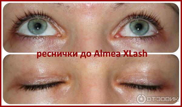 Средство для роста ресниц Almea XLash