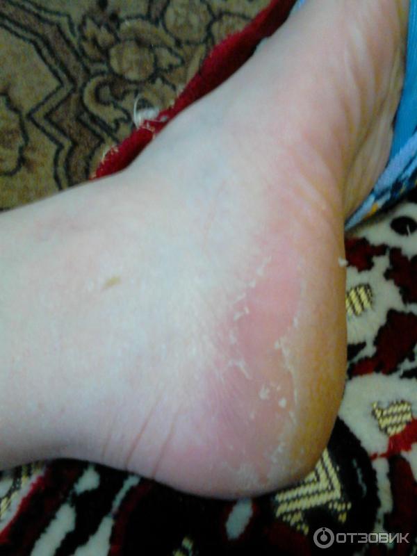 Носки педикюрные пилинговые MiFo Super Exfoliating Foot Socks For Pedicure фото
