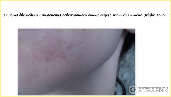 Освежающий тоник Lumene Refreshing Toner фото