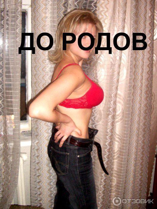 Абдоминопластика фото