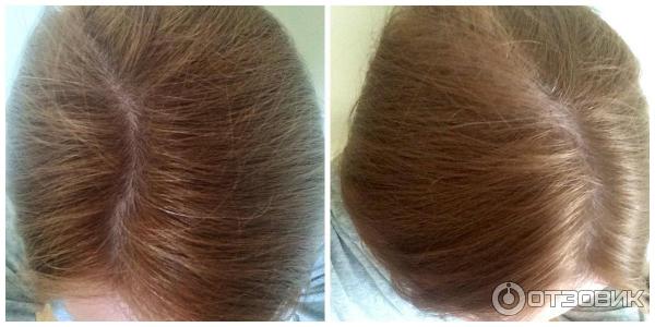 Восстанавливающие ампулы против выпадения волос для женщин Vichy Dercos Technique Aminenexil Pro фото