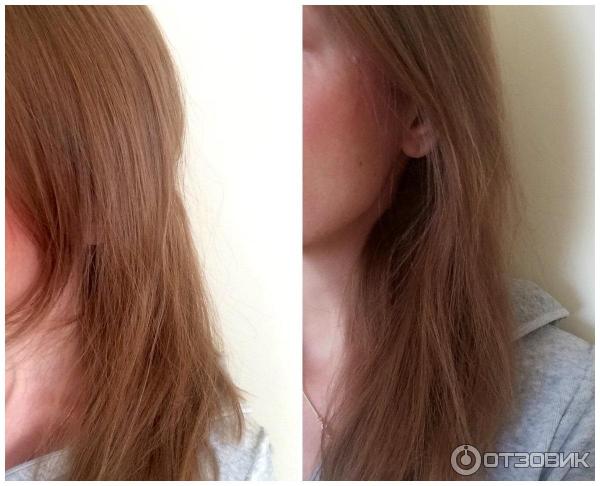 Восстанавливающие ампулы против выпадения волос для женщин Vichy Dercos Technique Aminenexil Pro фото