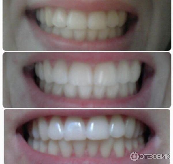 Crest 3D White Whitestrips