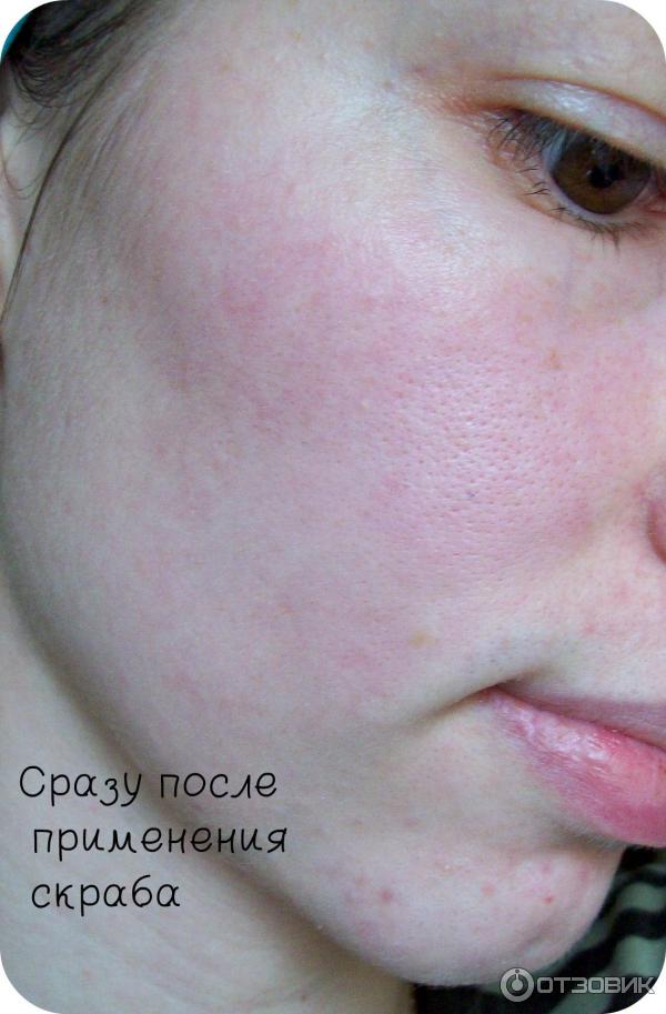 Тонизирующий скраб Avon Clearskin для глубокой очистки пор фото