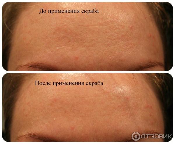 Отшелушивающий скраб для лица L'Oreal Совершенное сияние фото