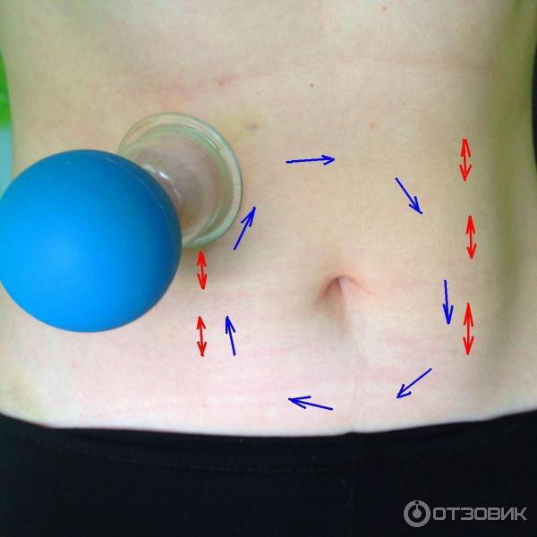 Как делать вакуумный массаж живота банкой. Вакуумно баночный массаж живота. Маскаж банками вакумным.
