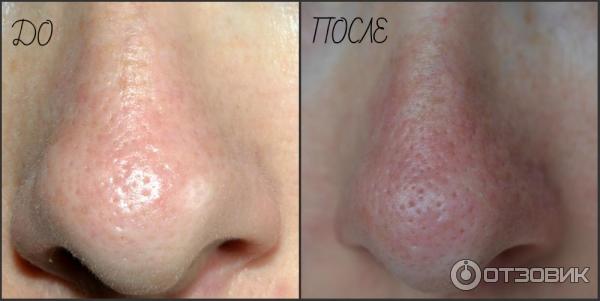 Полоски для очищения пор носа Tony Moly Egg Pore Nose Pack фото