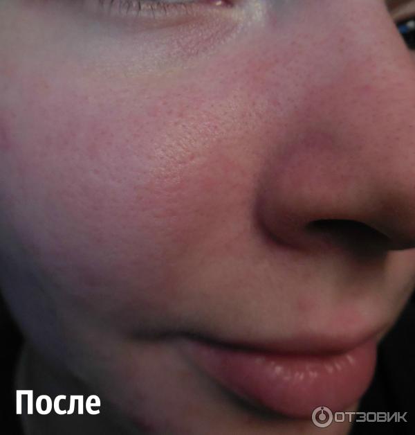 Увлажняющая эмульсия для лица La Roche-Posay Effaclar Mat фото