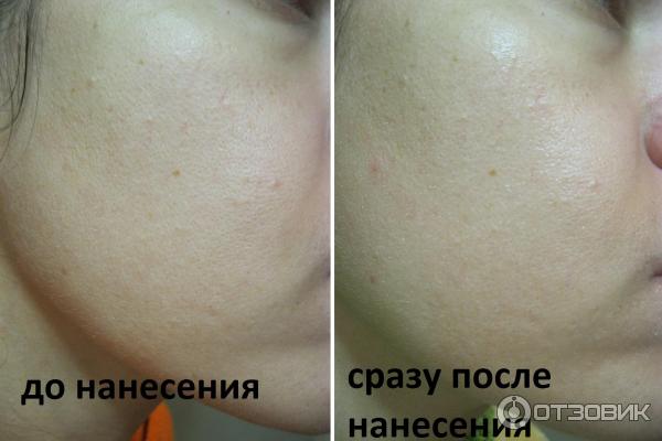 Сыворотка Vichy LiftActiv Serum 10 фото