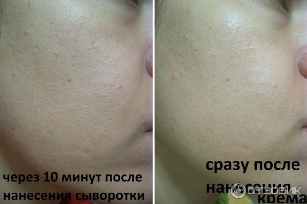 Сыворотка Vichy LiftActiv Serum 10 фото