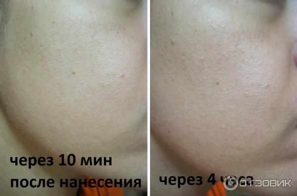 Сыворотка Vichy LiftActiv Serum 10 фото