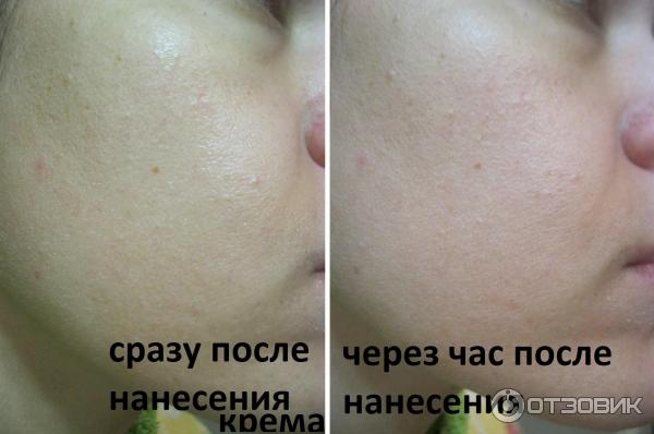 Сыворотка Vichy LiftActiv Serum 10 фото