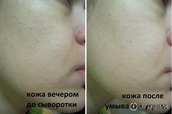 Сыворотка Vichy LiftActiv Serum 10 фото